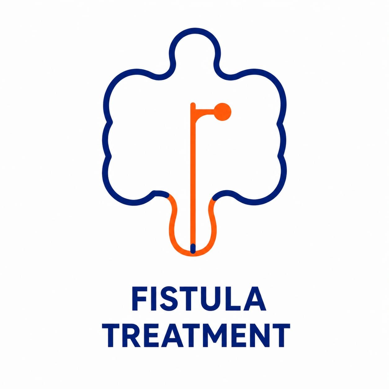 Fistula