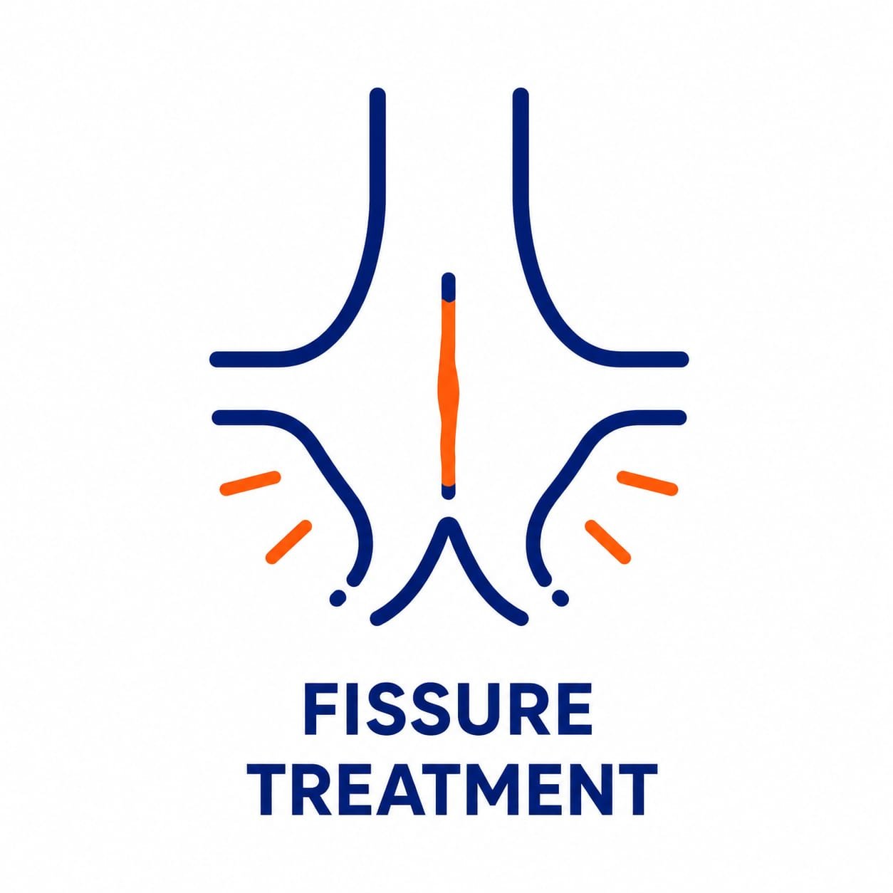 Fissure